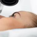 An Introduction to PRK Laser Type