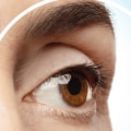 How to Use a Vision Care Plan to Reduce PRK Costs