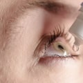 Understanding the Benefits of Eye Drops After PRK Surgery