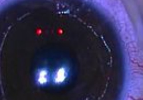 The Effects of Corneal Haze Following PRK