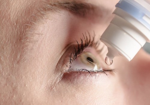 Understanding the Benefits of Eye Drops After PRK Surgery