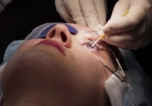 Benefits of PRK: Overview and Procedure
