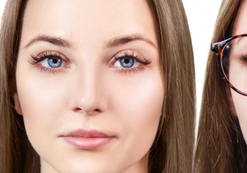 The Benefits of Vision Correction Surgery